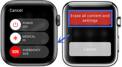 Works Forgot Apple Watch Passcode How to Reset It